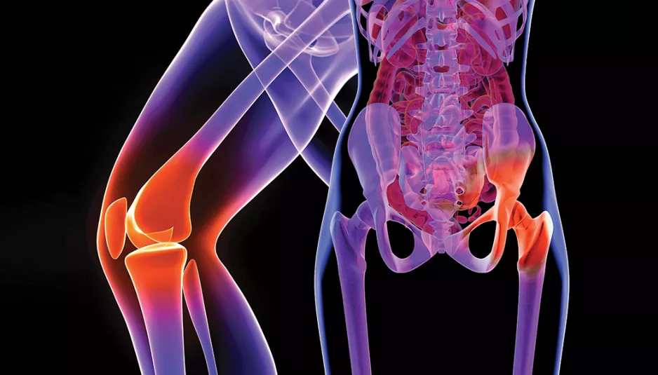 How Long Does It Take To Recover Fully From Hip Replacement